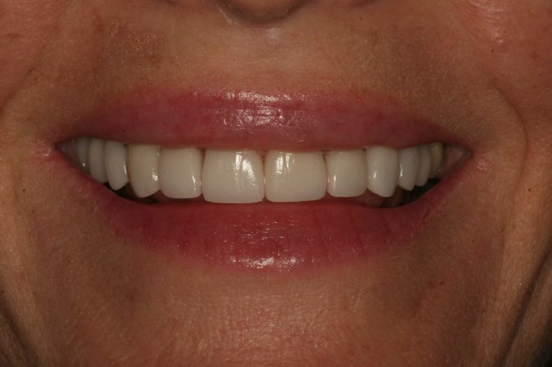 Patient photo showing before and after