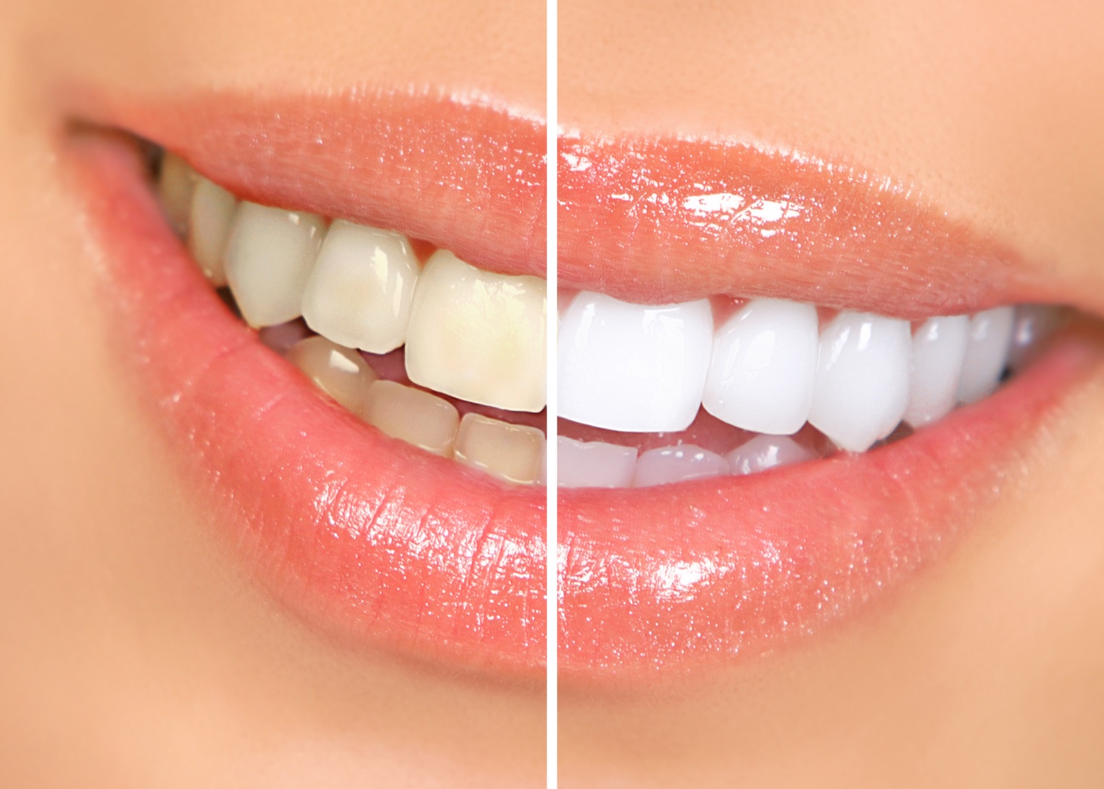 Smiling woman mouth with great teeth. Over white background